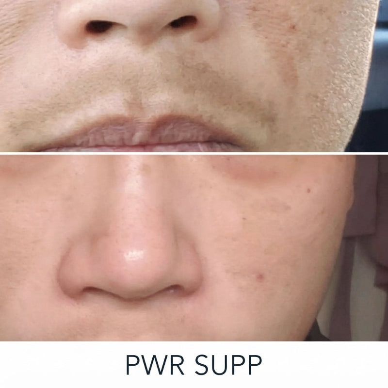 Dark Spot Brightening Gel