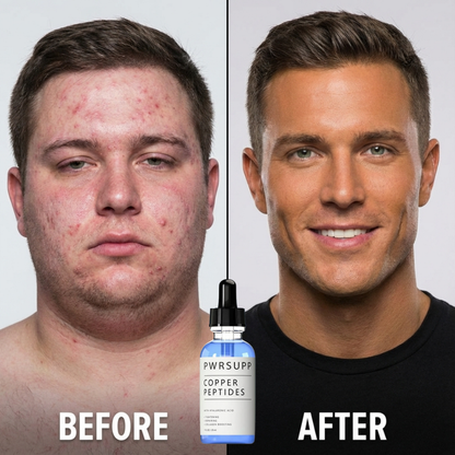 Blue Copper Facially Masculline