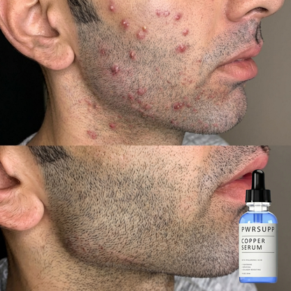 Blue Copper Facially Masculline