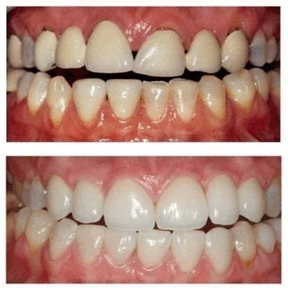 Gum & Teeth Repair Gel
