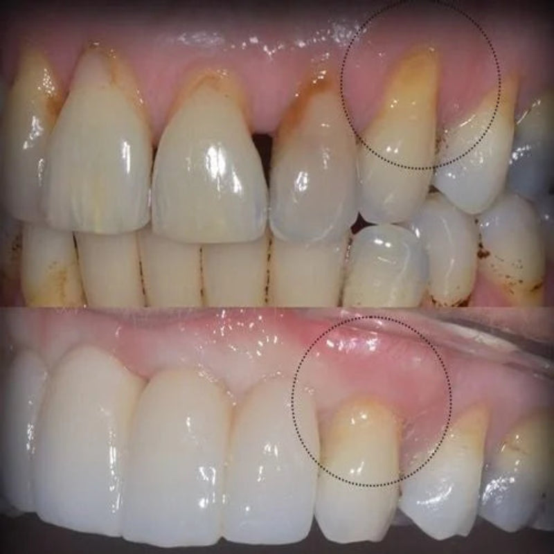 Gum & Teeth Repair Gel