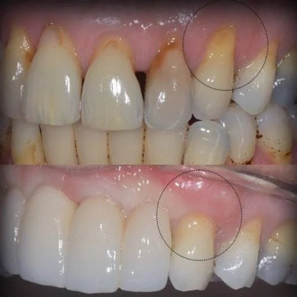 Gum & Teeth Repair Gel