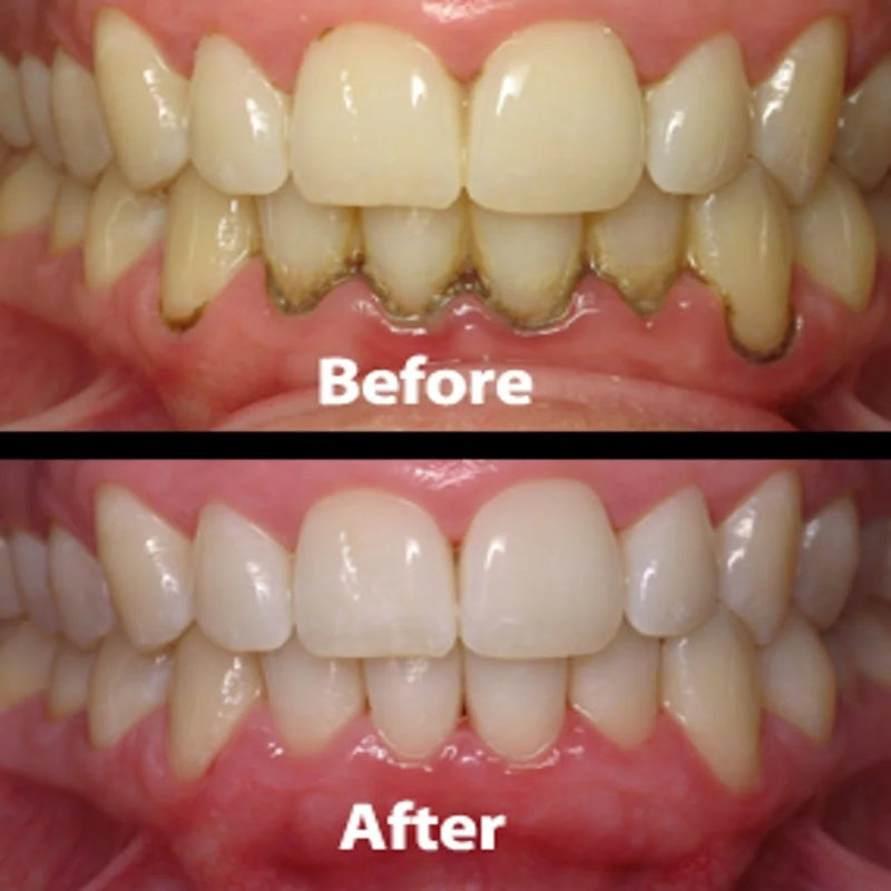 Gum & Teeth Repair Gel