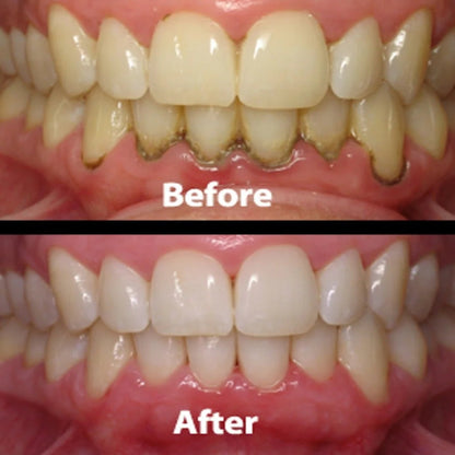 Gum & Teeth Repair Gel