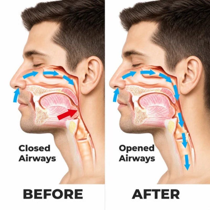 Anti-Snoring Throat Spray