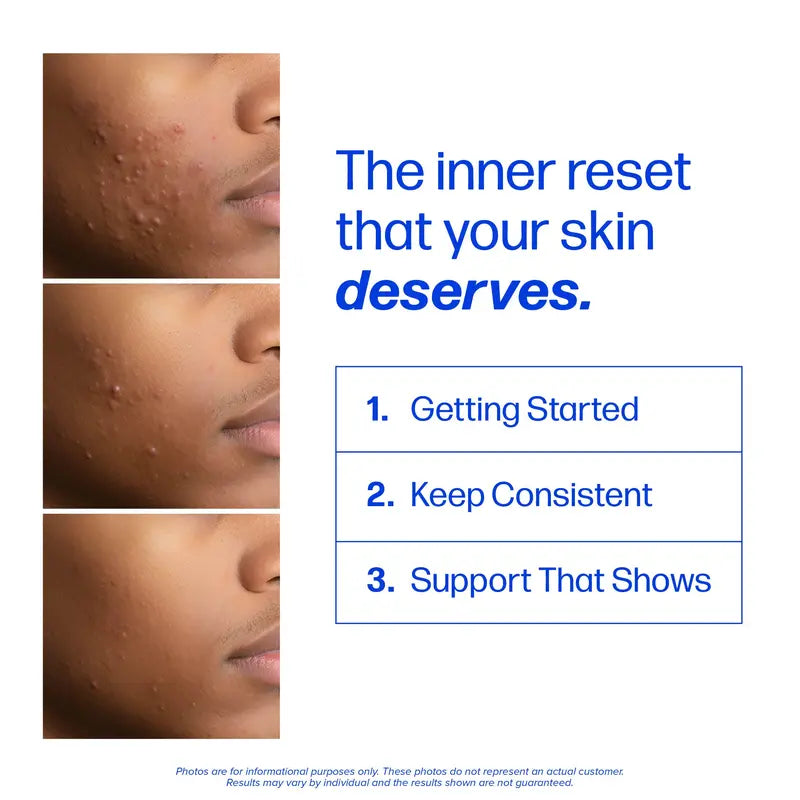Clear Skin Support Capsules