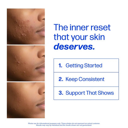 Clear Skin Support Capsules
