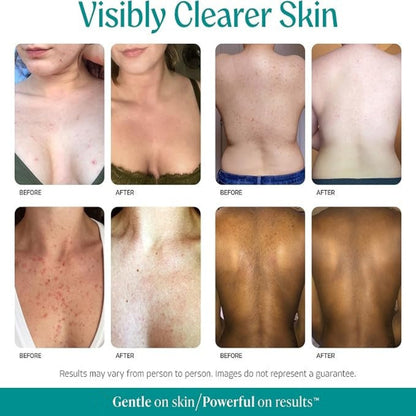 Level 2 Mandelic Acid Body Serum