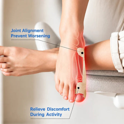 Bunion Corrector Tape – 20PCS