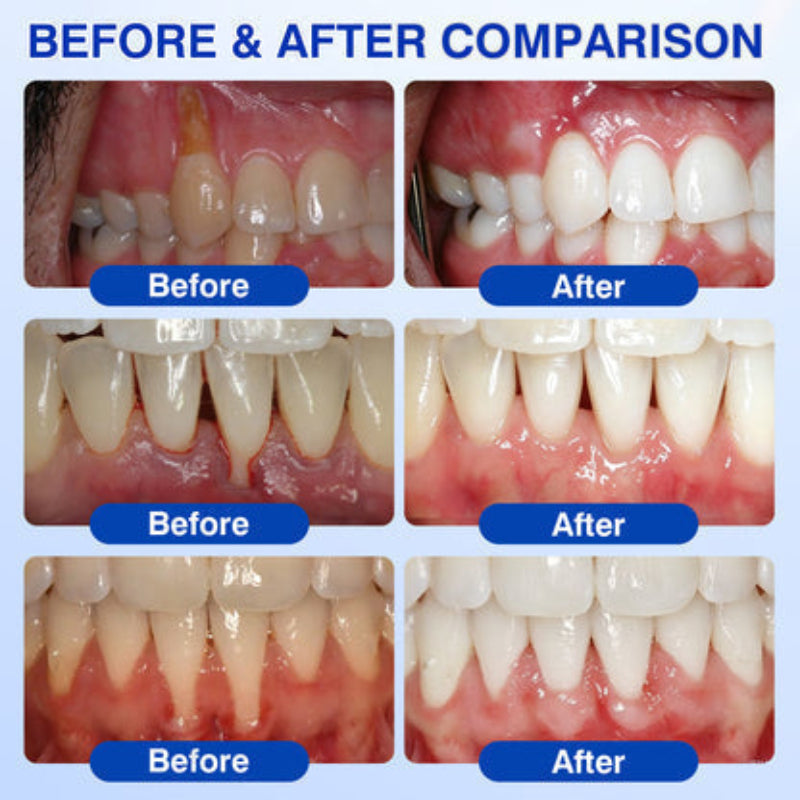 PWR-Periodontal Repair Gel