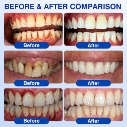 PWR-Periodontal Repair Gel