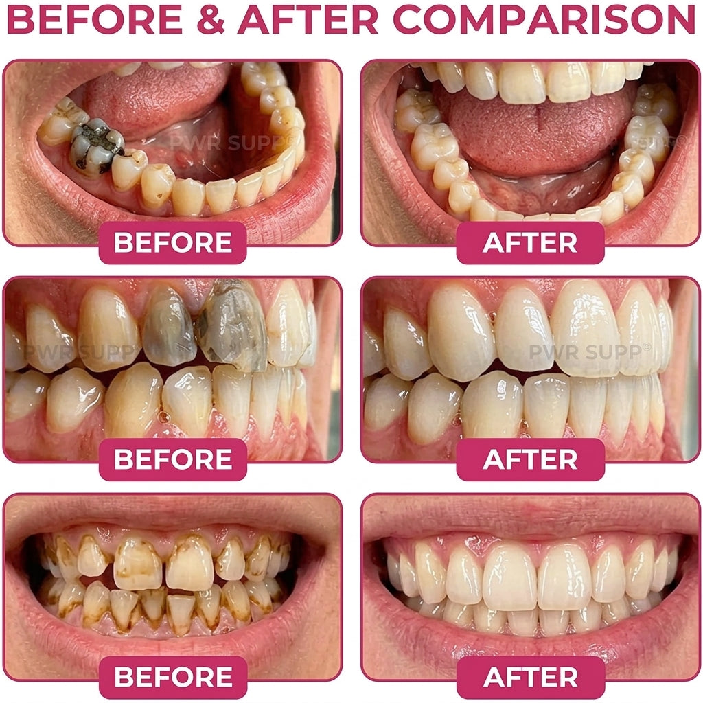 Hydroxyapatite Enamel Care Gel