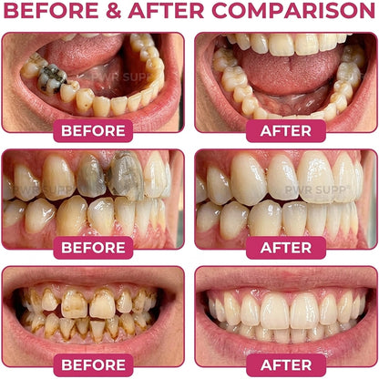 Hydroxyapatite Enamel Care Gel