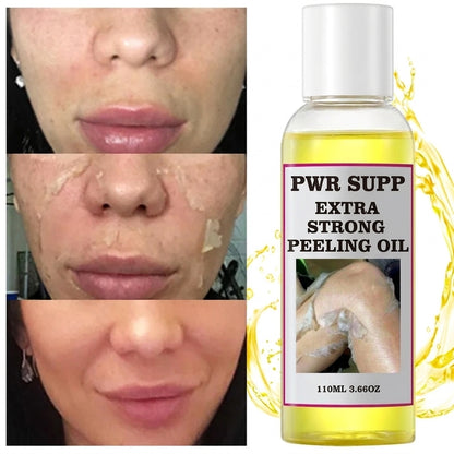 Yellow Peeling Oil for Dark Spots & Rough Skin