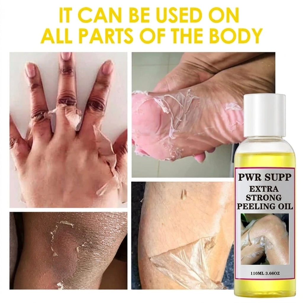 Yellow Peeling Oil for Dark Spots & Rough Skin
