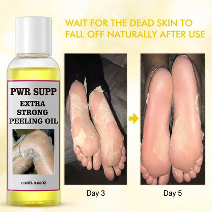 Yellow Peeling Oil for Dark Spots & Rough Skin