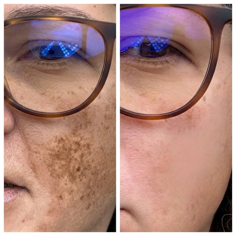 Dark Spot Brightening Gel