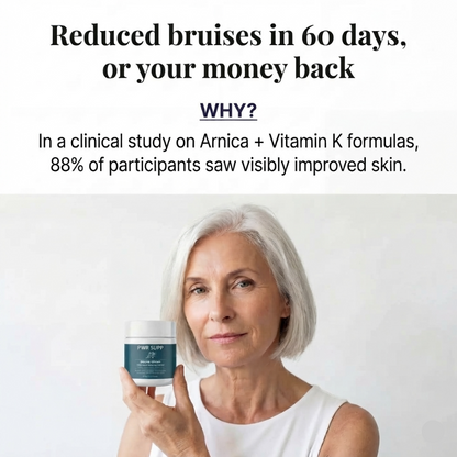 Bruise Recovery Cream – Arnica & Vitamin K
