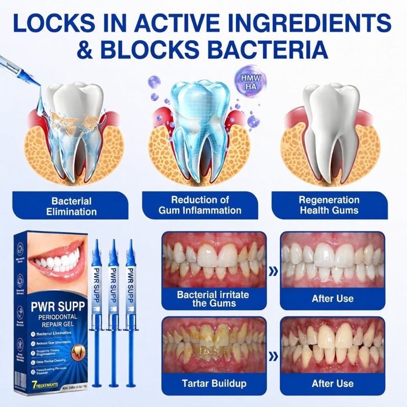 PWR-Periodontal Repair Gel