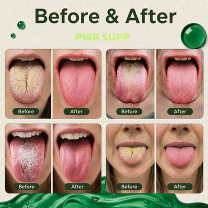 Anti-Bad Breath Herbal Gel