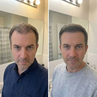 PWR-Natural DHT Blocker