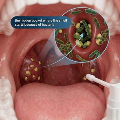 Tonsil Stone Spray