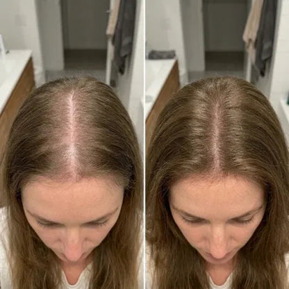 Korean Scalp Revival Bar