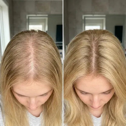 Korean Scalp Revival Bar